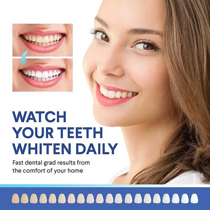 professional teeth whitening wholesale teeth whitening kit