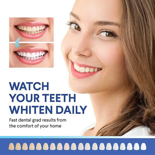 professional teeth whitening wholesale teeth whitening kit(10 Pack)