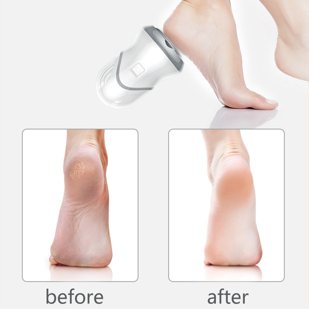 High Quality Callus remover Electric Rechargeable Foot Scrubber Pedicure Tools for Removing Dead Skin