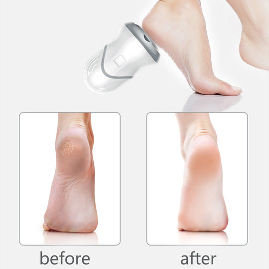 High Quality Callus remover Electric Rechargeable Foot Scrubber Pedicure Tools for Removing Dead Skin