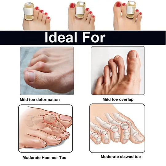 Premium Quality Compression Finger Splints with Flexible Built-in Aluminium Support(Bulk 3 Sets)